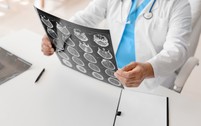 Traumatic Brain Injury (1)